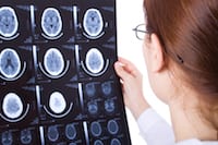 A medical professional examines CT scan images displayed on a lightboard.