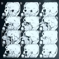 Cranial ultrasound images displayed on a lightboard, showing detailed views of the brain.