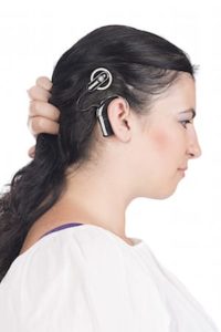 cochlear implant