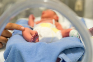 A premature baby in an incubator.