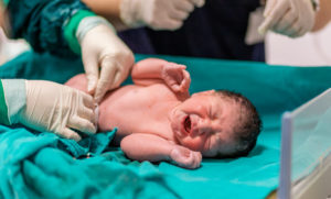 A crying baby's umbilical cord being cut in a delivery room