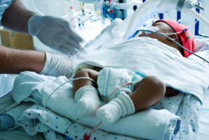 An infant receiving treatment for meningitis in a hospital