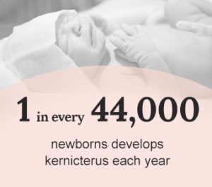 1 in every 44,000 newborns develops kernicterus each year