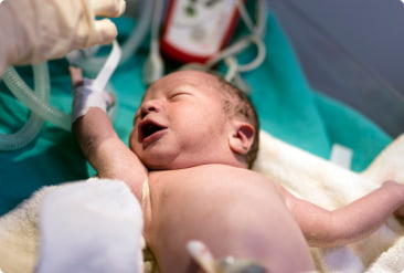 A newborn receives care in a delivery room, with arm raised and wrapped in medical tape connected to monitoring equipment.
