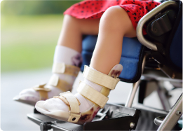 A close-up of a child's legs in a wheelchair, wearing leg braces.