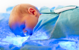 A newborn lying on blue lights receiving phototherapy treatment for jaundice.