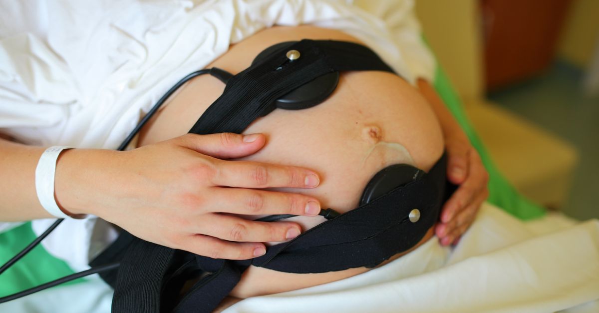 A mother is outfitted with a fetal monitor during labor